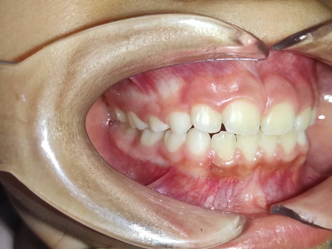 Odontopediatría - consulta para niños