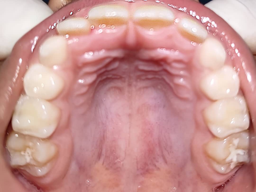 Primera visita dentista niños Caracas