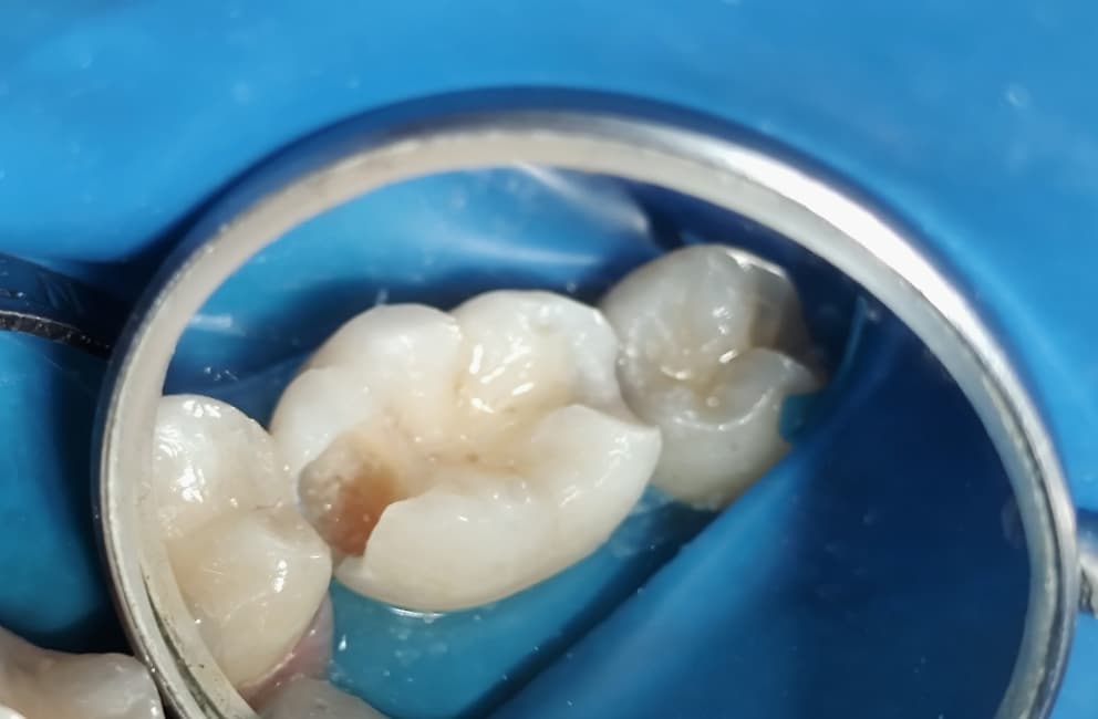 Consulta de odontología general en Caracas - Dra. Johanny Hernández