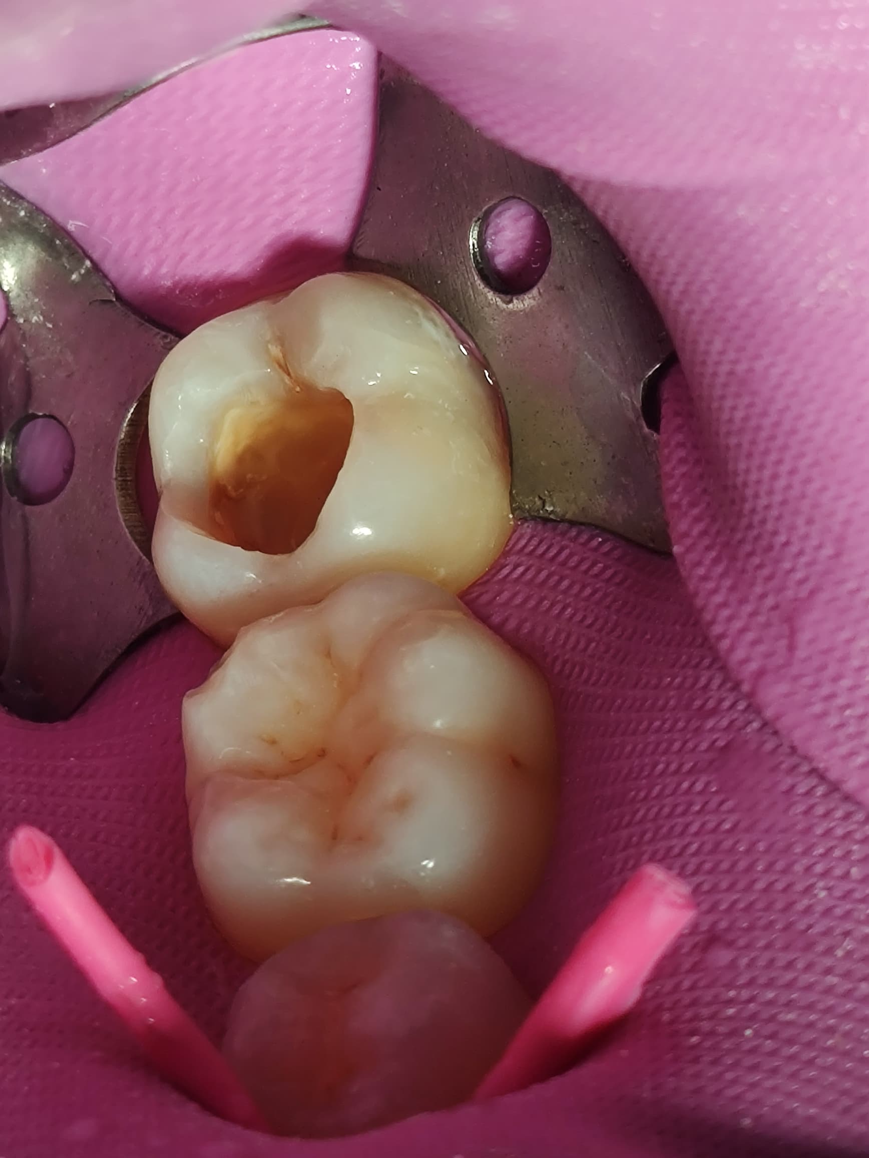 Reconstrucción dental Caracas