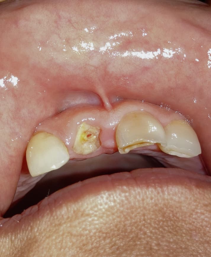 Emergencias Dentales